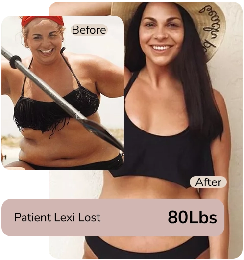 Medical weight loss program patient transformation before and after results